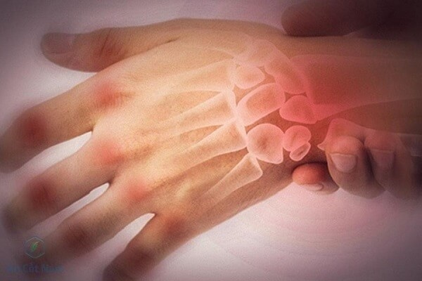 Đau tay trái, nguyên nhân và cách massage giảm đau